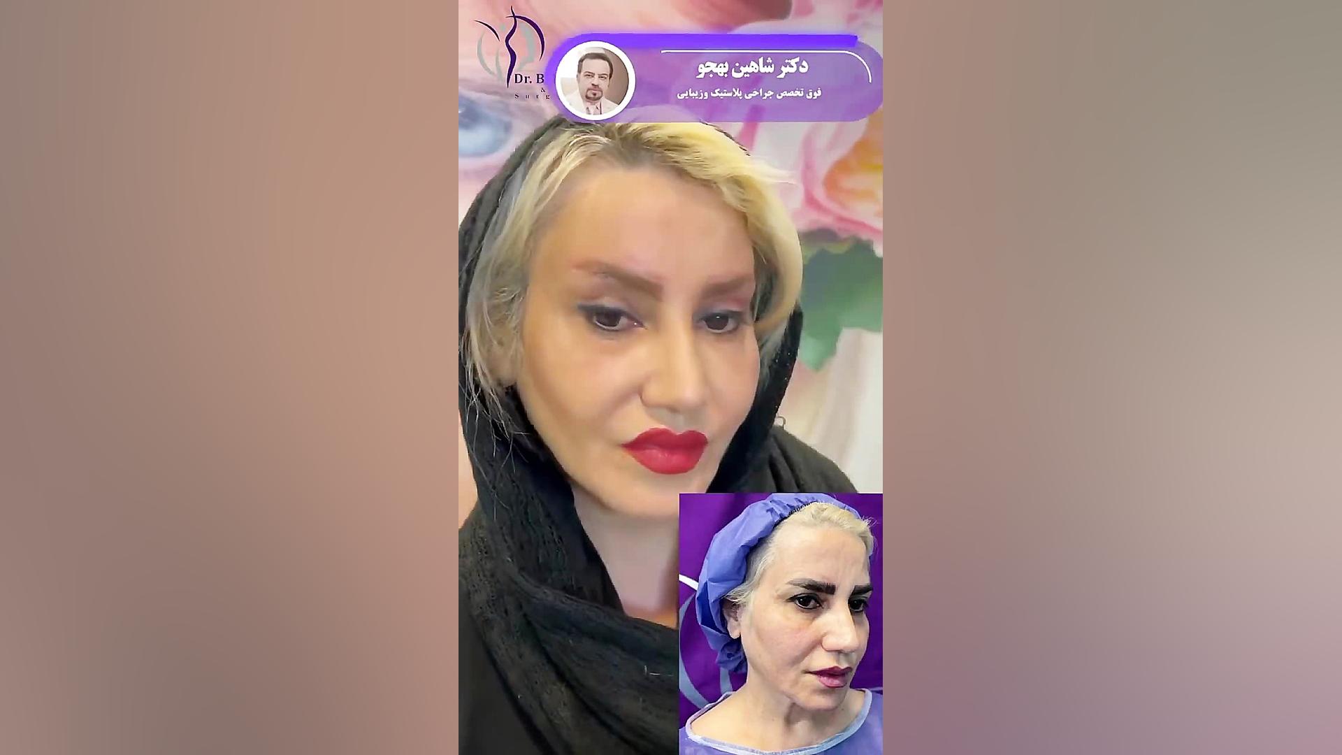 لیفت ابرو و این همه تغییر خفن تنها در یک جلسه دکتر شاهین بهجو - فوق تخصص جراحی پلاستیک