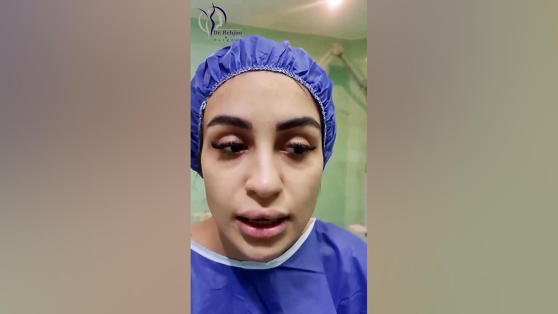 جراحی بینی نیمه فانتزی در زیباجوی عزیزمون دکتر شاهین بهجو - فوق تخصص جراحی پلاستیک