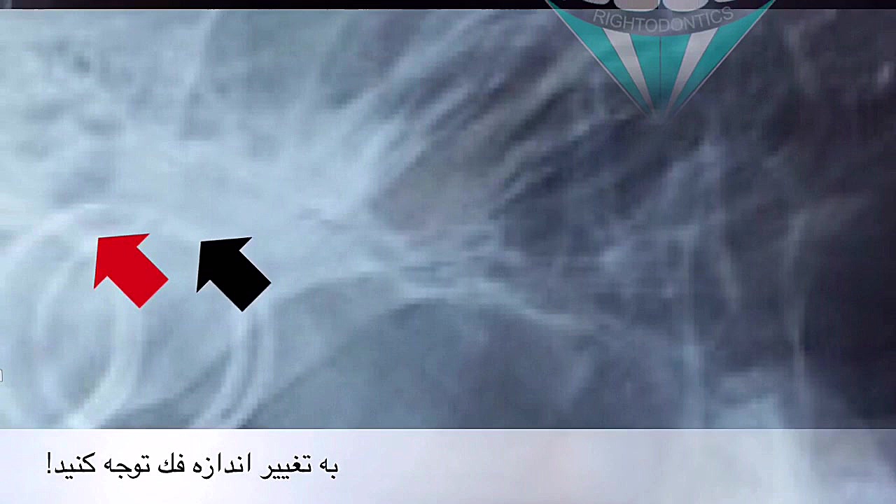 معجزه فانكشنال تراپى (ارتوپدى فك و صورت) ولاگر