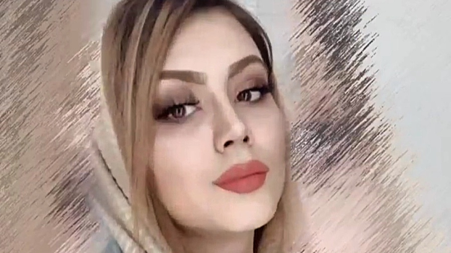 رضایت زیبا جو از جراحی زیبایی بینی دکتر علی باقری حق