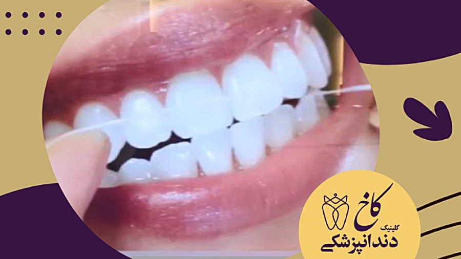 یک روز عادی در کلینیک دندانپزشکی کاخ کلینیک دندانپزشکی کاخ