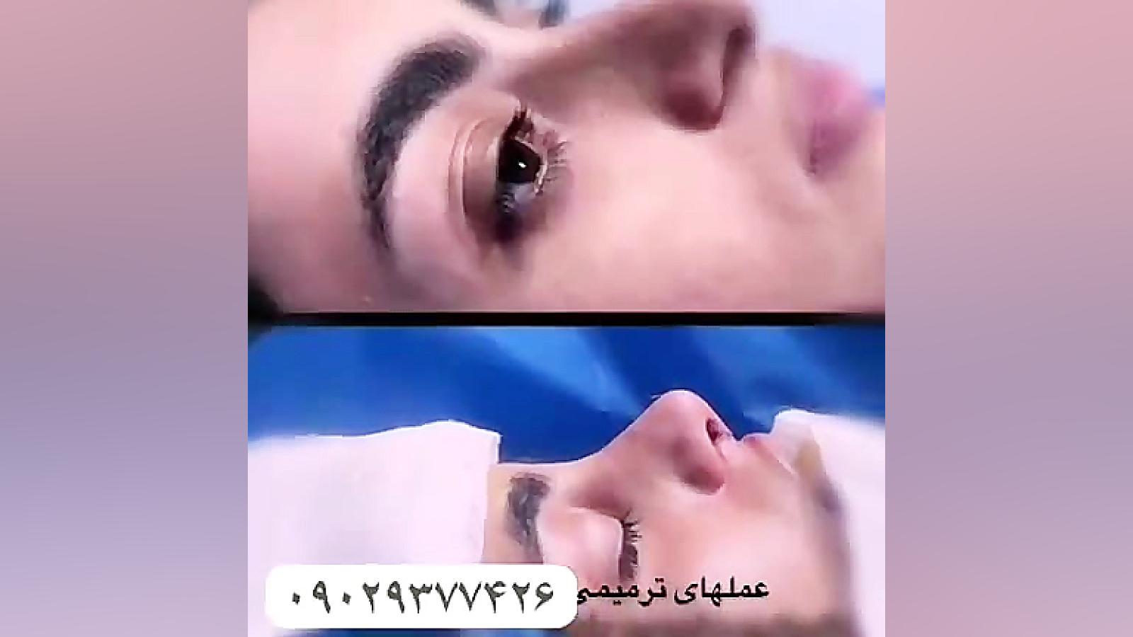 دکتر اسماعیل عارف زاده ، جراح گوش و حلق و بینی ماموپلاستی