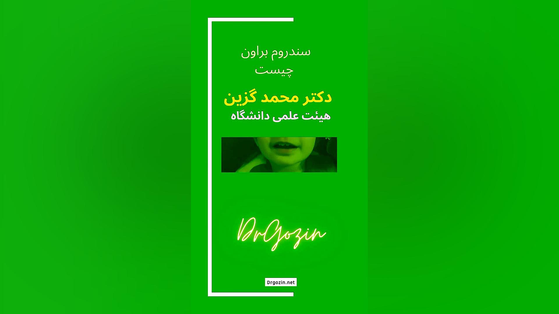 بهترین جراح انحراف چشم دکتر گزین و توضیح سندروم براون بیورآکتور سه‌بعدی