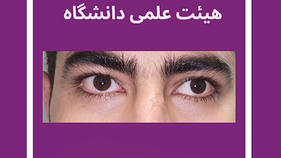 درمان انحراف چشم با بی حسی موضعی، دکتر گزین فوق تخصص استرابیسم آر اف فرکشنال