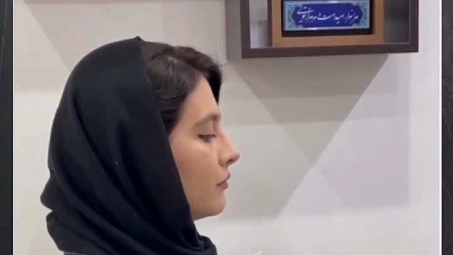 نتیجه جراحی زیبایی بینی با دکتر بنایی