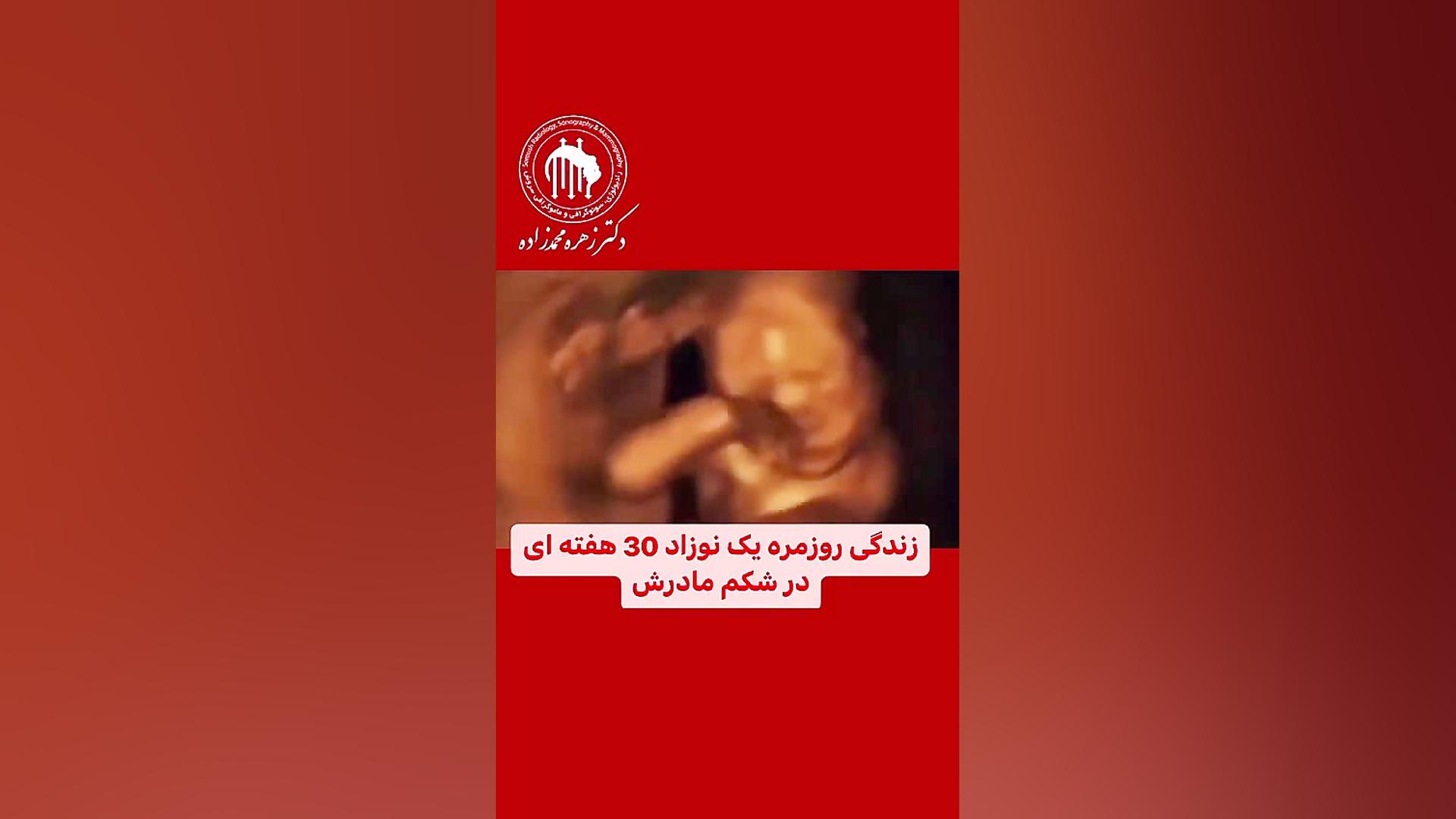 سونوگرافی جنین 30 هفته ای سیروان خسروی