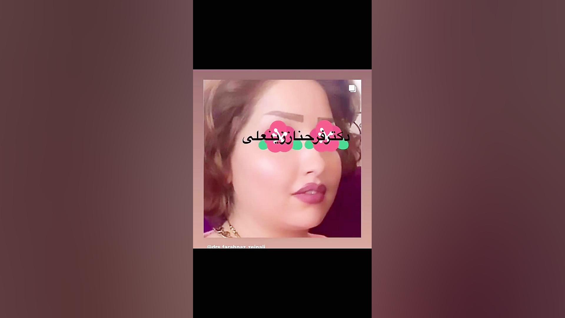 جوانی و زیبایی دائمی با تزریق چربی توسط دکترفرحناززینعلی دکتر فرحناز زینعلی - متخصص پوست، مو، زیبایی زنجان