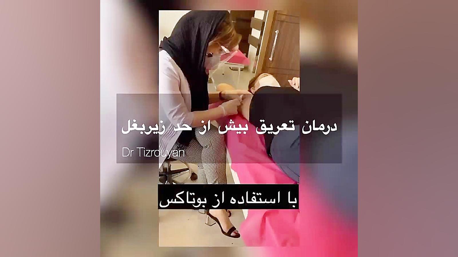 تزریق بوتاکس زیر بغل ؛ کنترل و درمان تعریق شدید کلینیک پوست