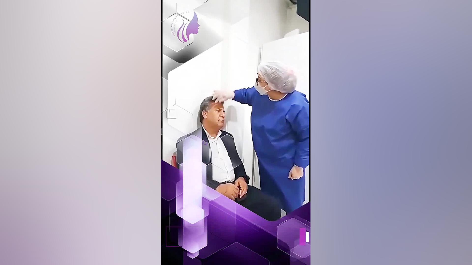 نتیجه کاشت مو دکتر صفیه چعباوی زاده
