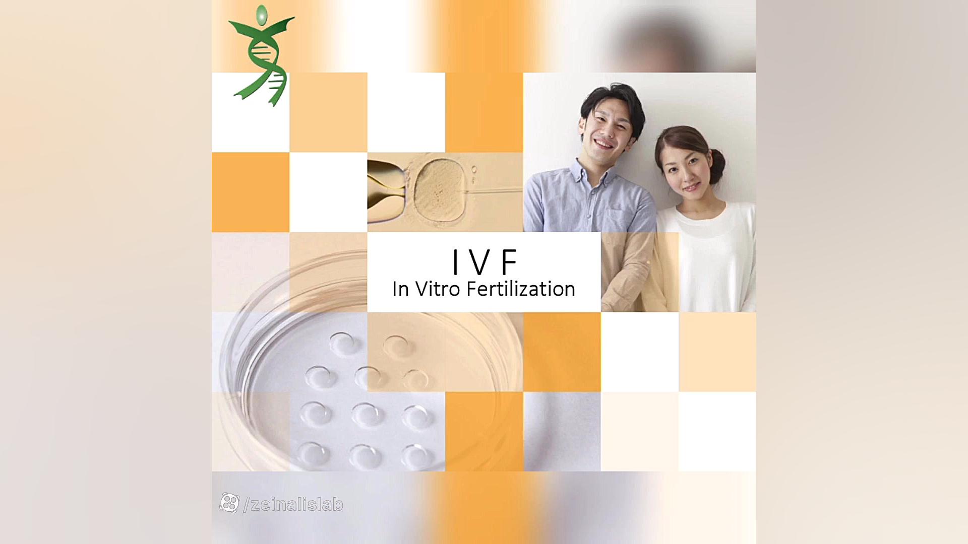 سندرم ترنر کلینیک دندانپزشکیایمونولوژی پیوند