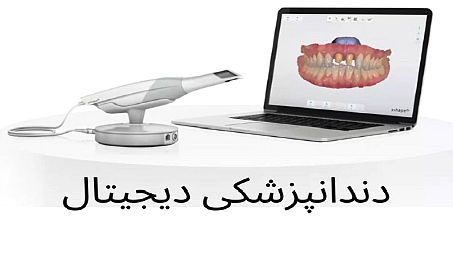 اسکن 3 بعدی دندان در کلینیک دندانپزشکی دکتر قاسم نژاد دندانپزشکی زیبایی دکتر قاسم نژاد