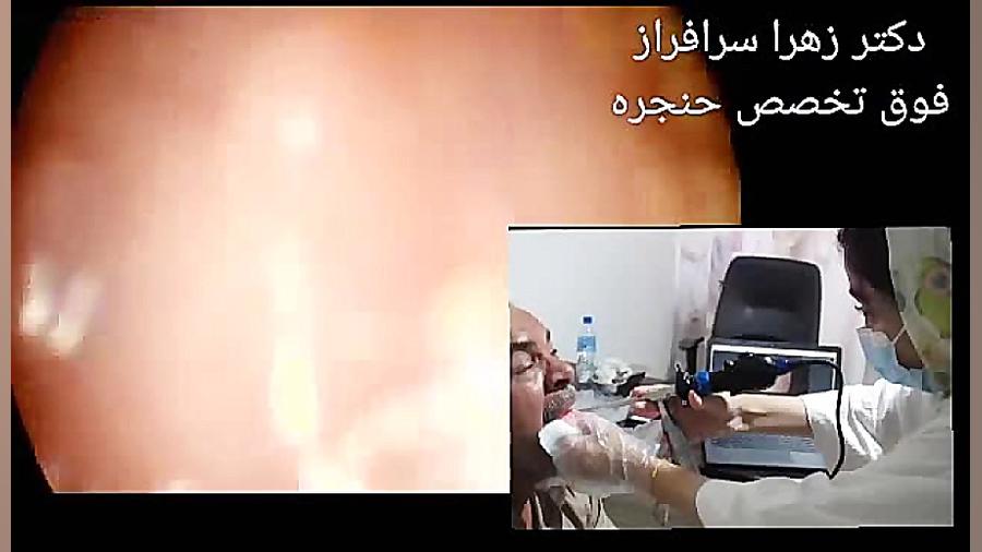 بهترین فوق تخصص حنجره در تهران، دکتر زهرا سرافراز اکستنشن تاج دندان