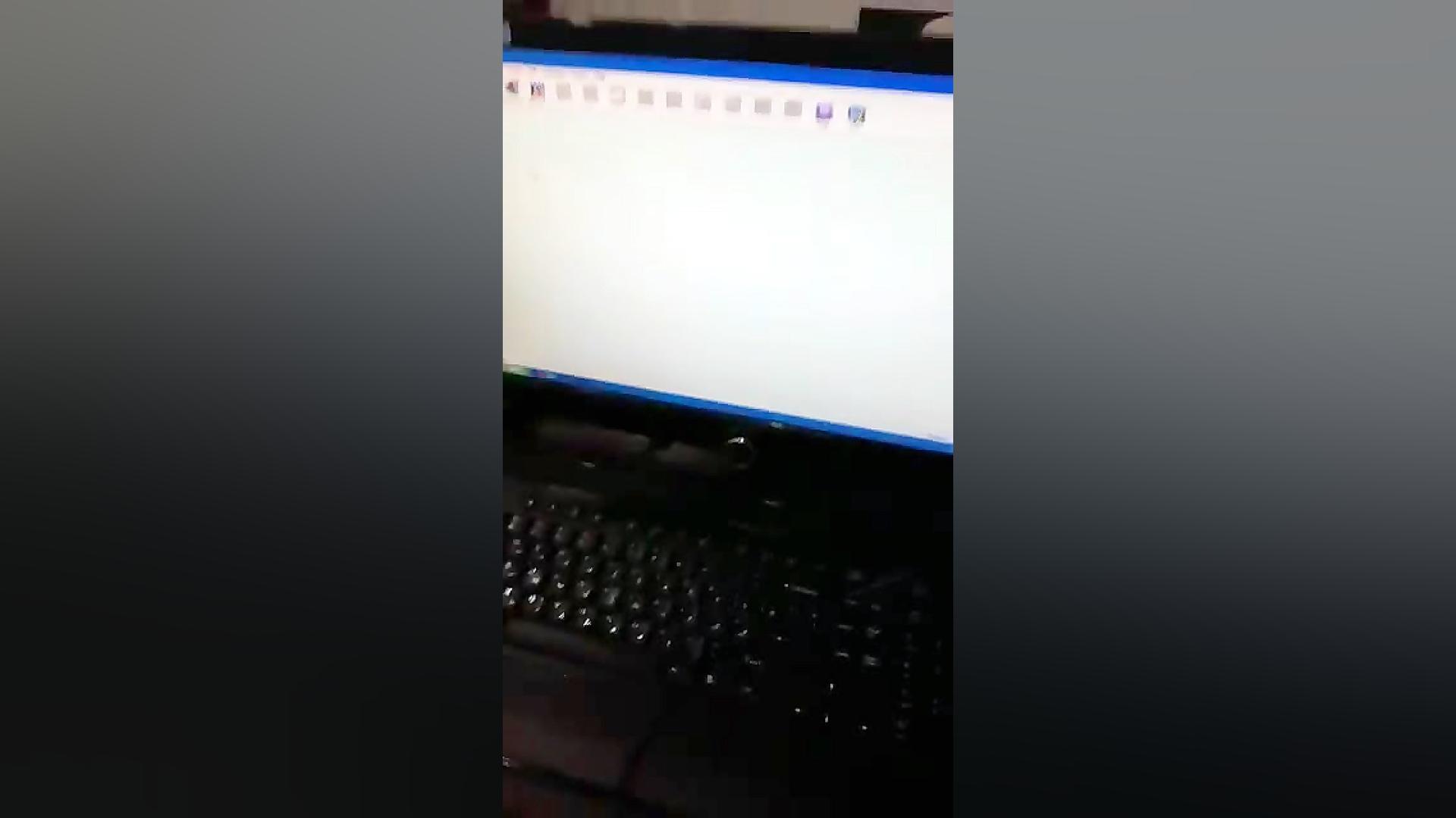 آموزش نرم افزار هولتر فشار خون کانتک contec جراحی زیبایی پلک