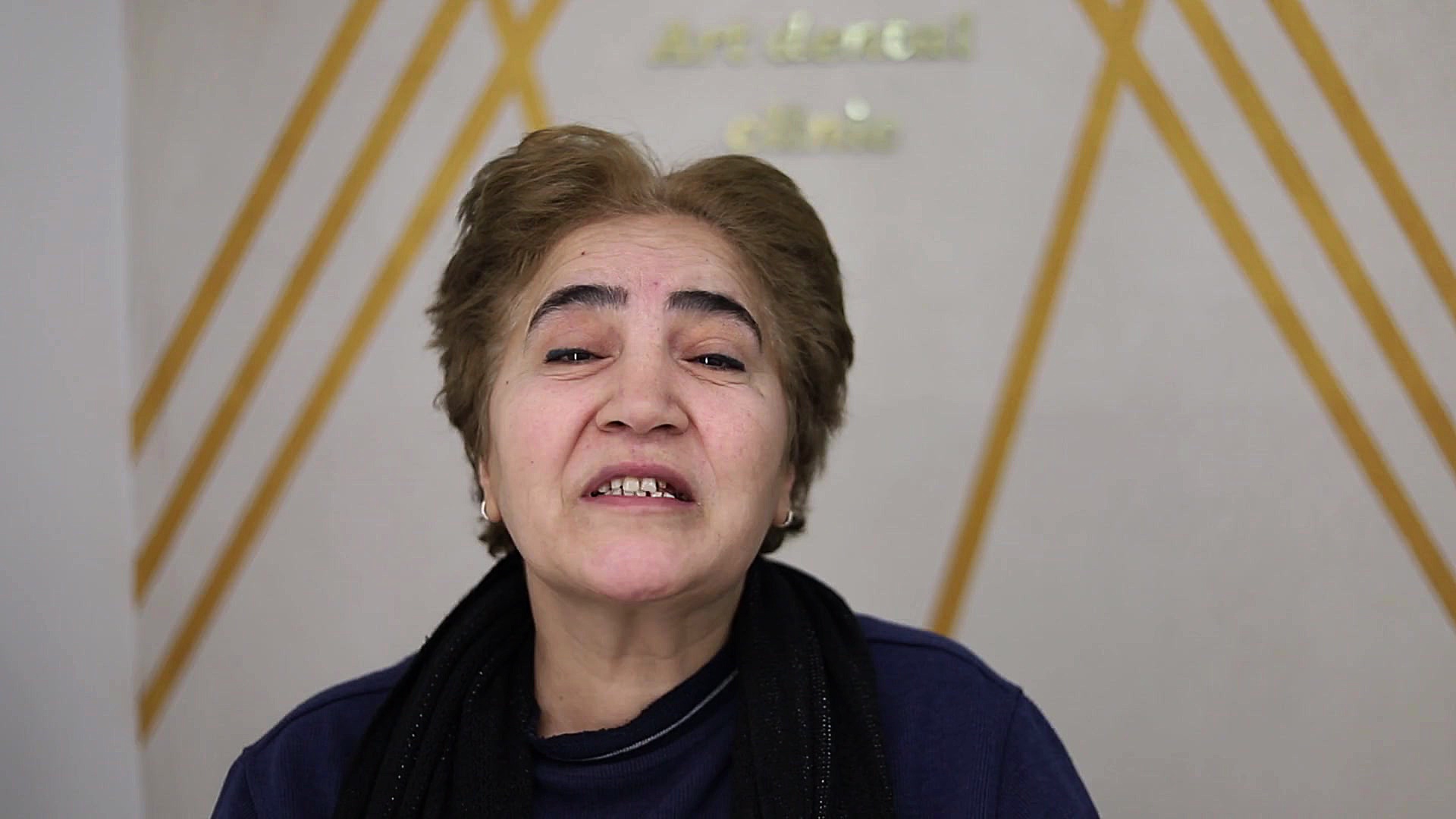 انجام 3 واحد ایمپلنت در کلینیک آرت دنتال دکتر شاکری کلینیک دندانپزشکی آرت دنتال دکتر شاکری