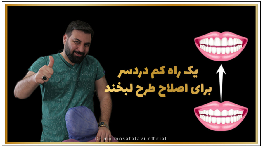 یک راه کم دردسر برای اصلاح طرح لبخند بیماری استئوجنز ایمپرفکتا