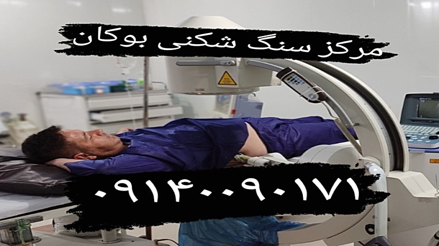 سنگ شکنی کلیه و‌مجاری اداری بوکان ۰۹۱۴۰۰۹۰۱۷۱ سینتولاژوماب