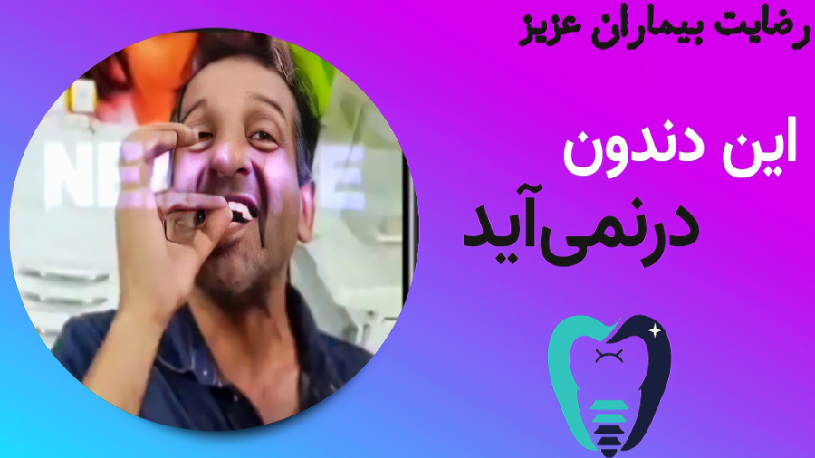 این دندون در نمیاد/بهترین دندان سازی اصفهان توپلیزوماب