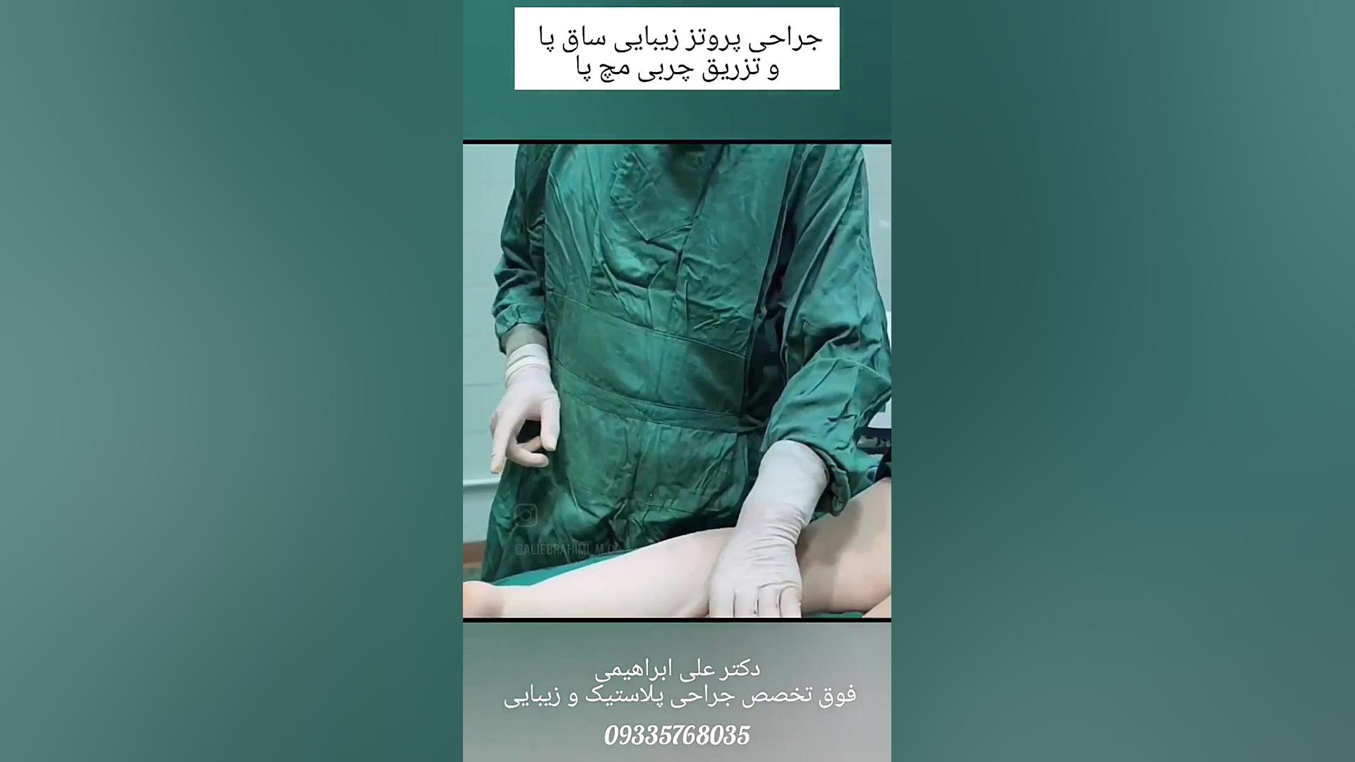 پروتز زیبایی ساق پا دکتر علی ابراهیمی فوق تخصص جراحی پلاستیک .