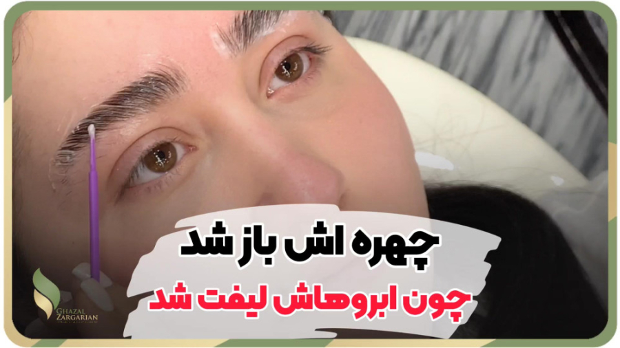 لیفت و لمینت ابرو با مواد در مرکز غزل زرگریان دستگاه چاپ زیستی سه‌بعدی