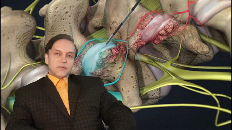 پرسش و پاسخ با استاد محمدرضا صفاری: بلوک عصبی اینسایزینگ