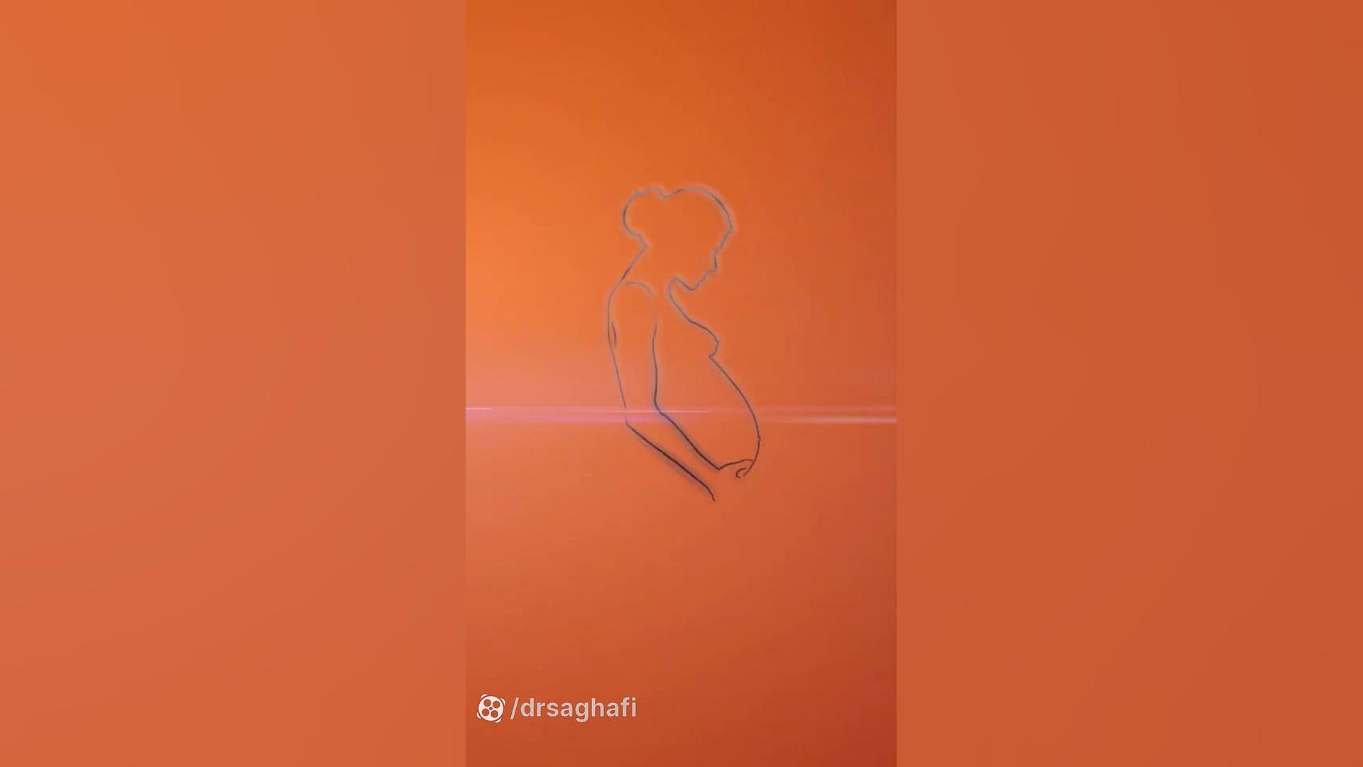 سونوگرافی nt تام کروز