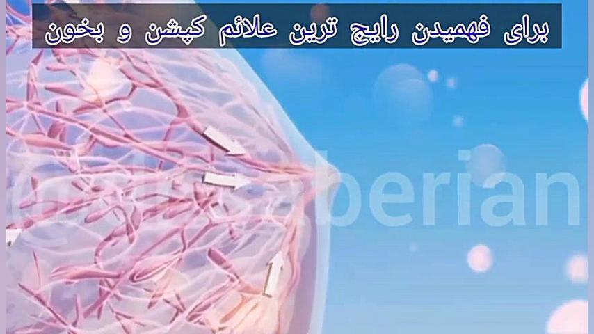رایج ترین علائم سرطان سینه لیفت گردنایمپلنت دندان