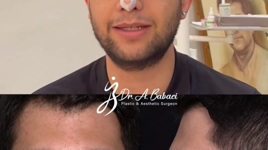 رضایتمندی بیمارمون از جراحی بینی دکتر علیرضا بابایی،فوق تخصص جراحی پلاستیک و زیبایی