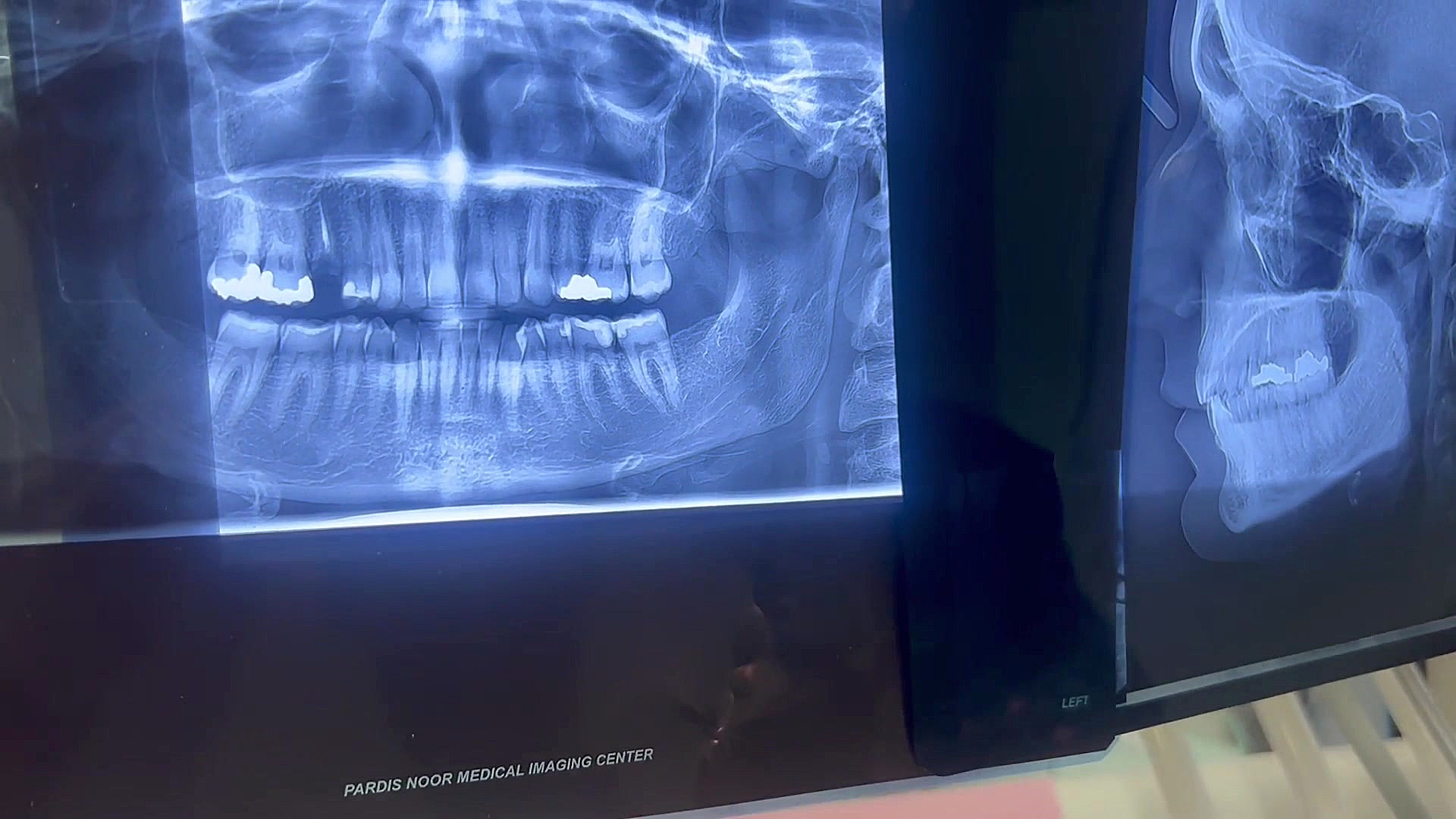 ارتودنسی سرامیکی رادینس آمریکایی دکتر فهیمی دكتر مهدي فهيمي هنزائي
