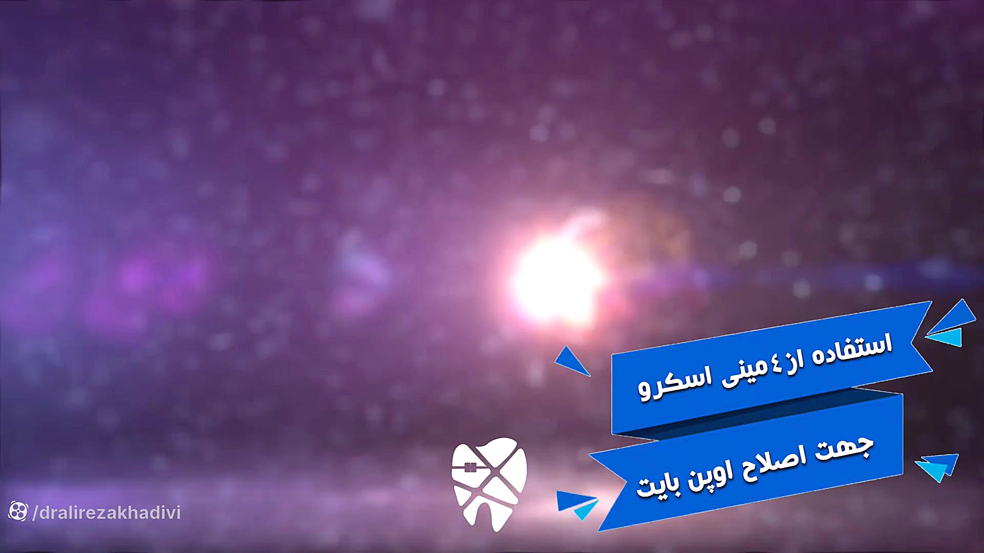 استفاده از مینی اسکرو برای اصلاح اوپن بایت دکتر علیرضا خدیوی
