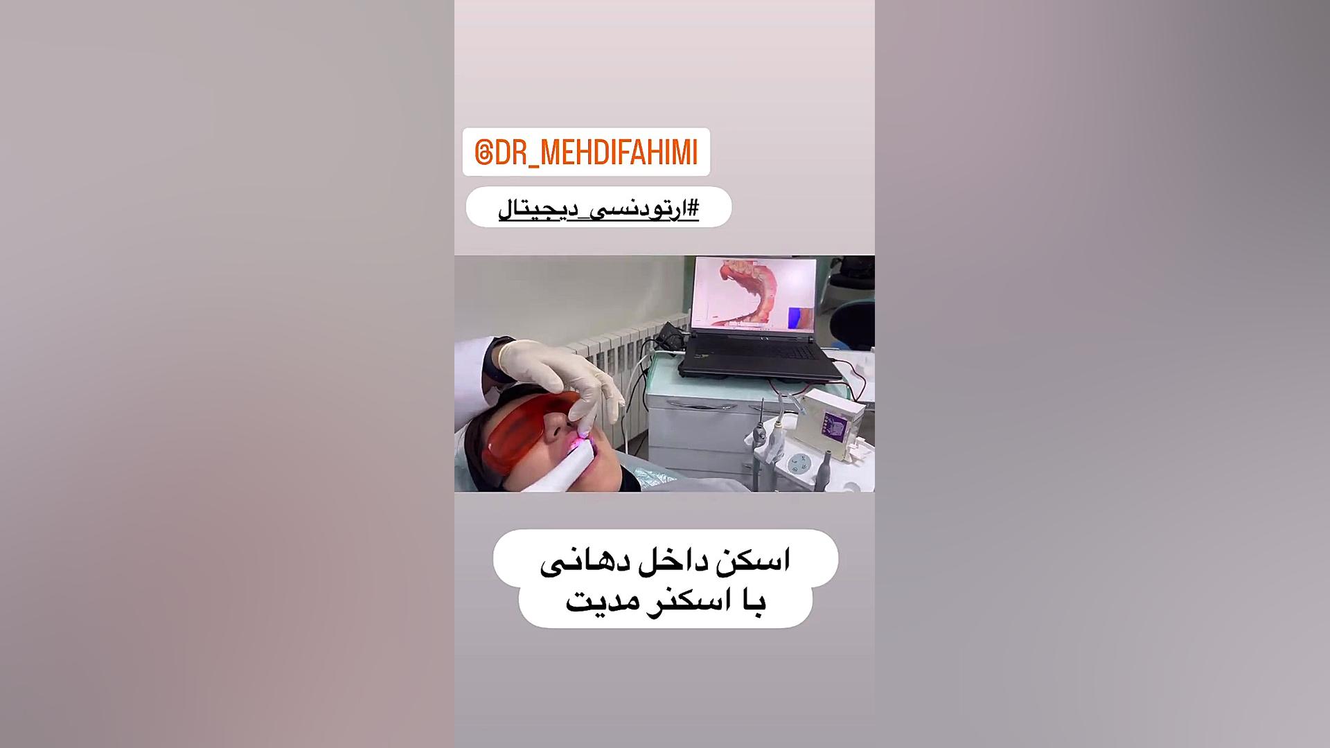 اسکنرداخل دهانی برای ارتودنسی دكتر مهدي فهيمي هنزائي