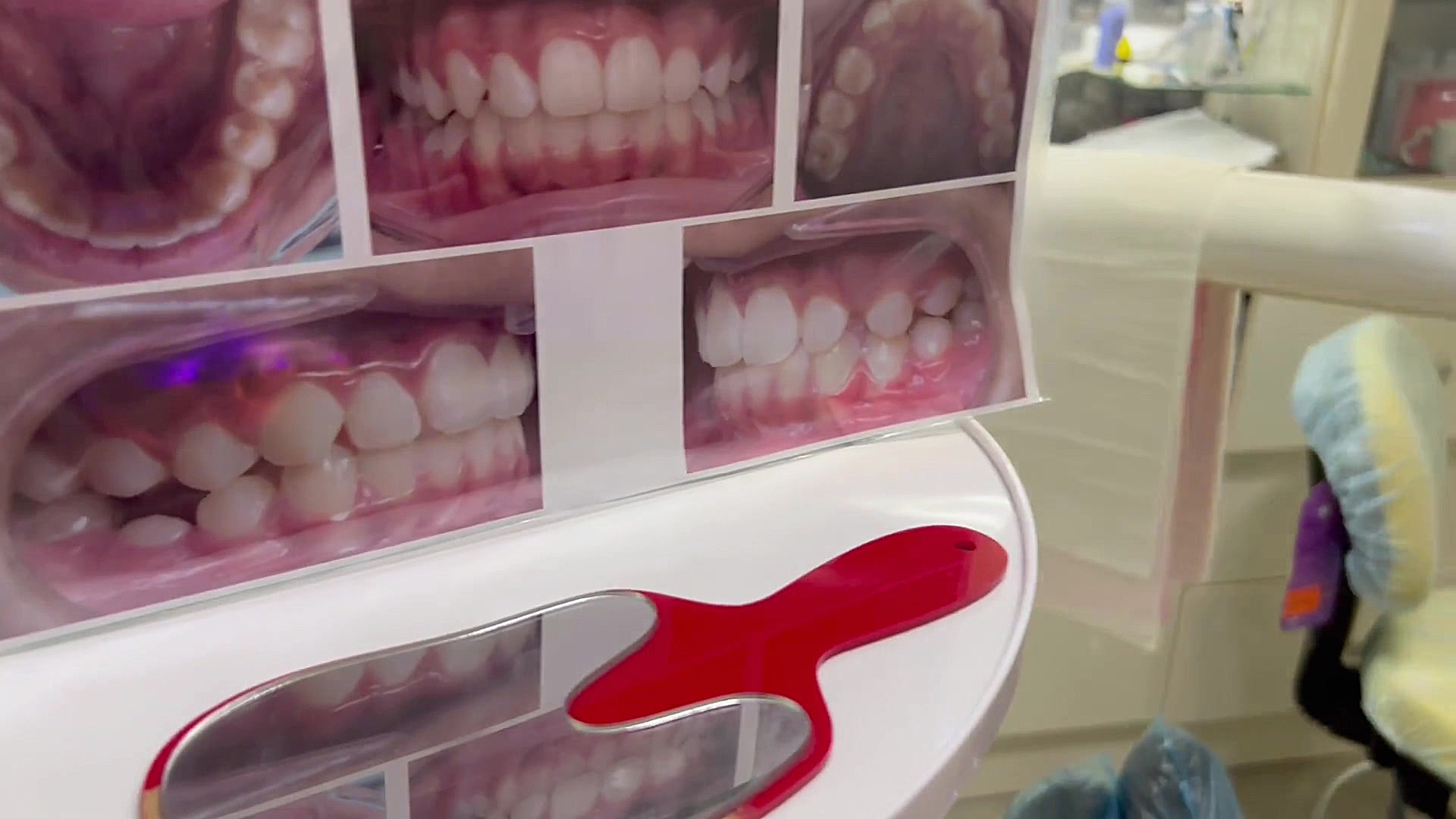 ارتودنسی به خاطر مشکل در طرح لبخند عالیه دكتر مهدي فهيمي هنزائي