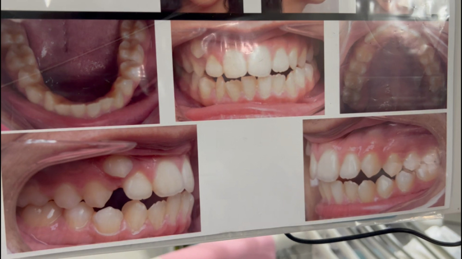 ارتودنسی در تهران دكتر مهدي فهيمي هنزائي