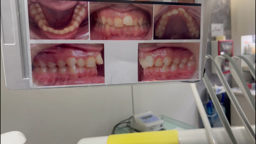 ارتودنسی سرامیکی و شفاف دكتر مهدي فهيمي هنزائي