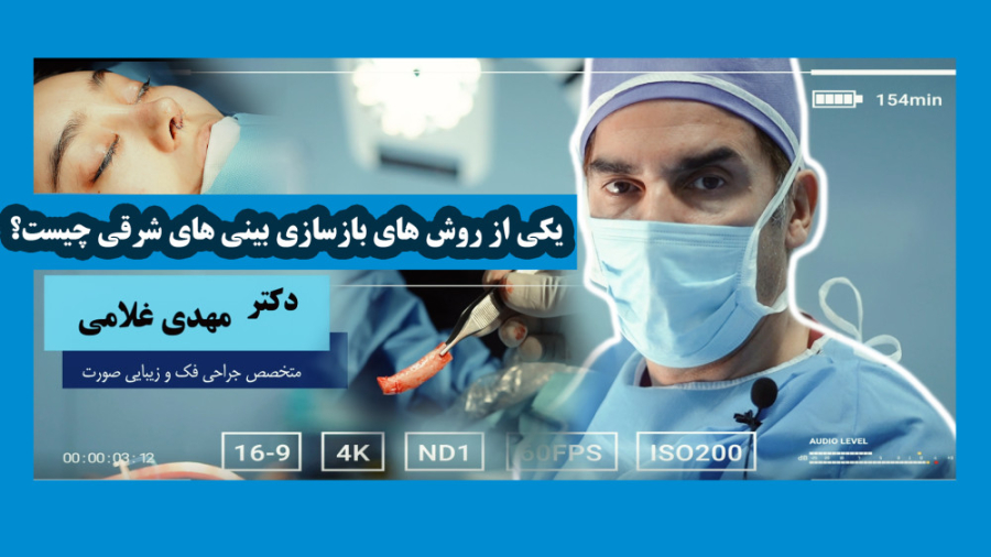 بازسازی بینی شرقی توسط دکتر مهدی غلامی در مشهد دکتر مهدی غلامی