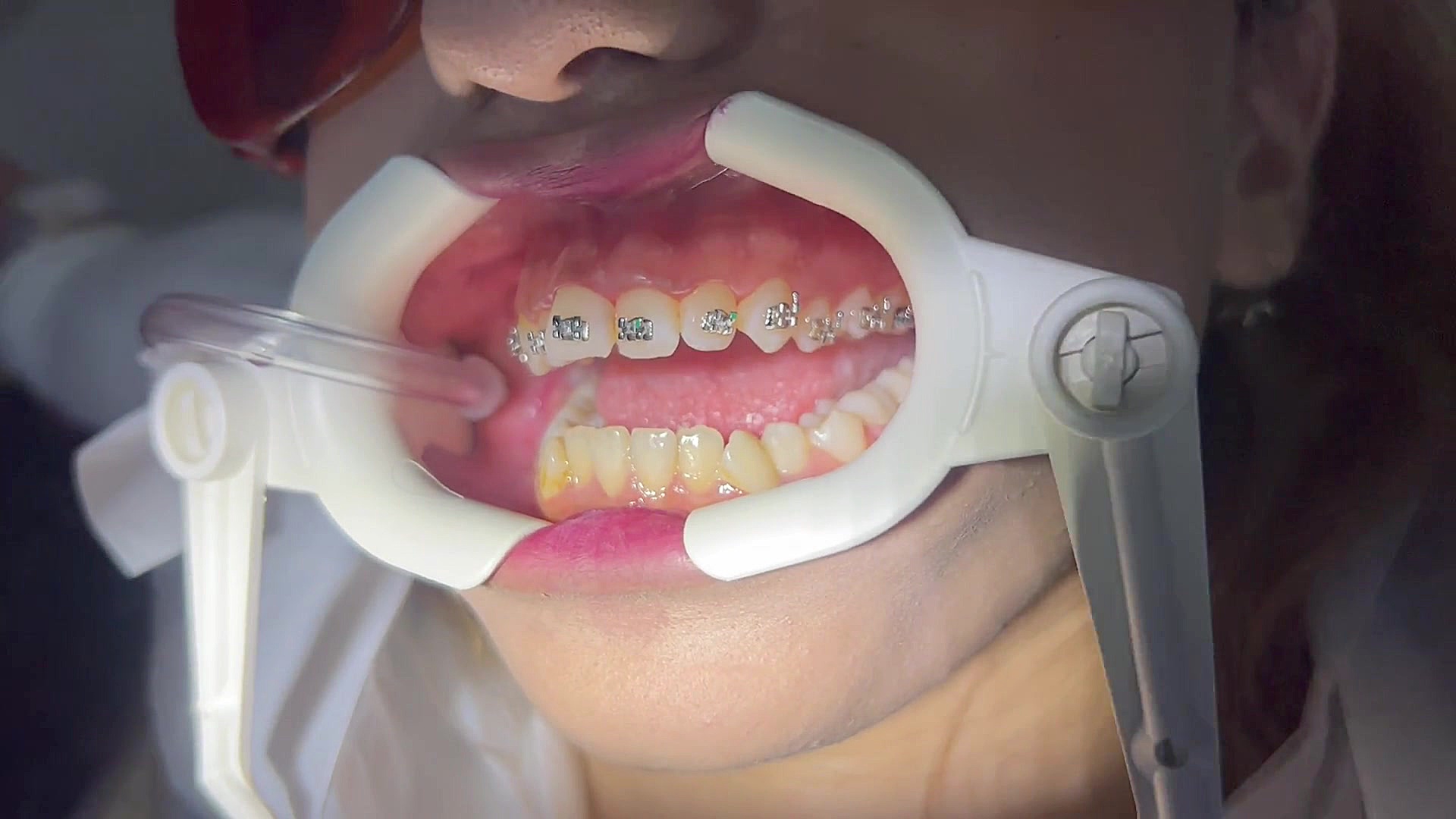 ارتودنسی در مرکز تهران دكتر مهدي فهيمي هنزائي