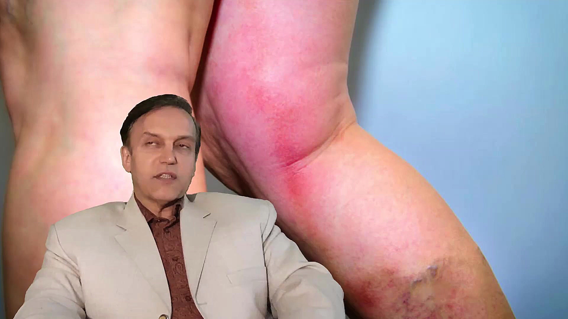 پرسش و پاسخ با استاد محمدرضا صفاری: سندروم دیستروفی رفلکسی سمپاتیکی پزشکی نانوذره‌ای