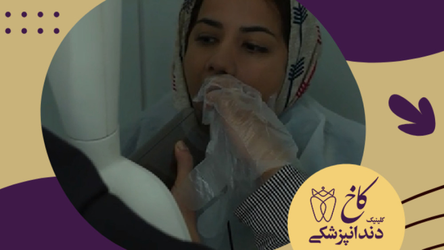 رادیوگرافی در کلینیک دندانپزشکی کاخ کلینیک دندانپزشکی کاخ