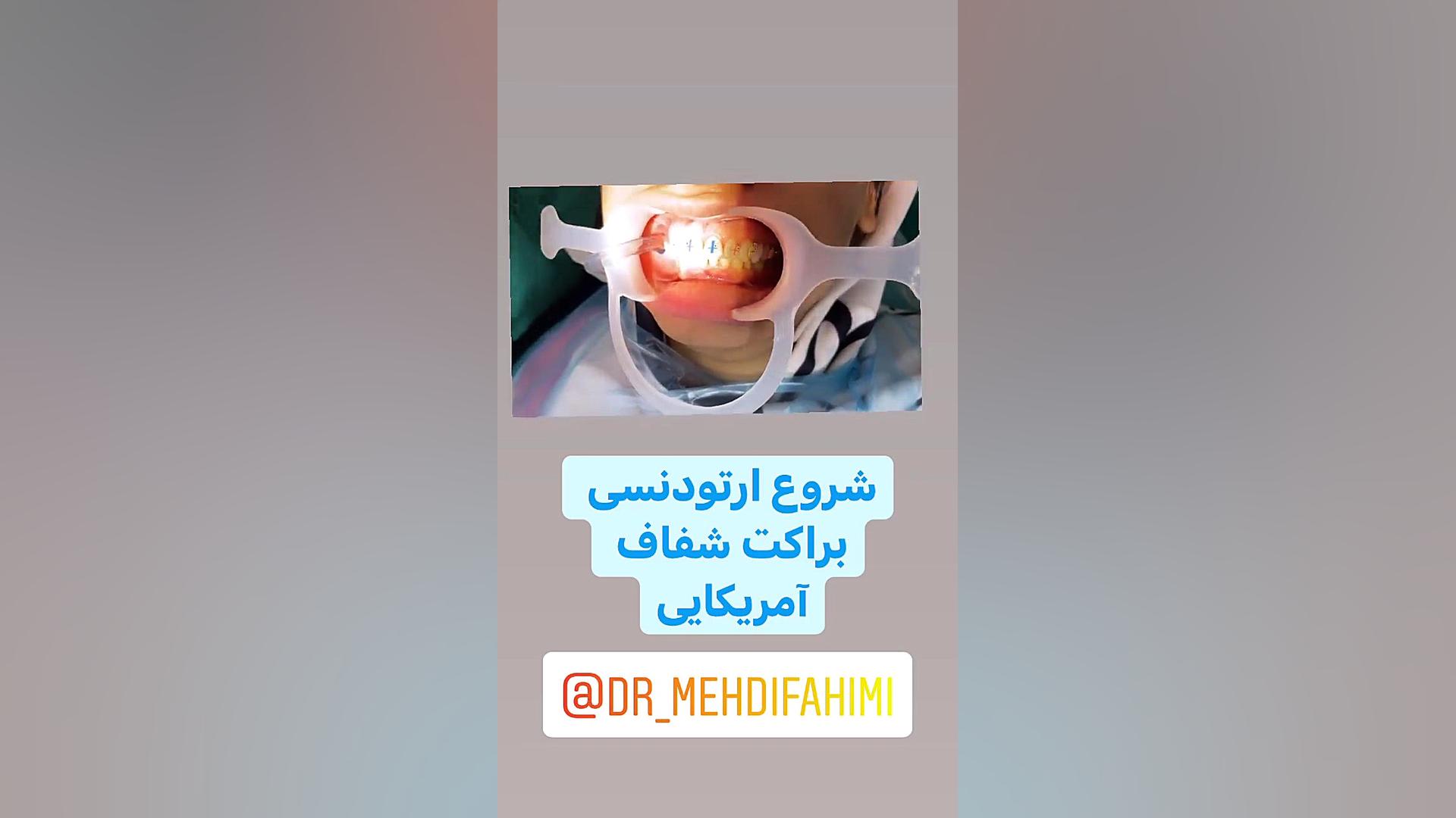 ارتودنسی دكتر مهدي فهيمي هنزائي