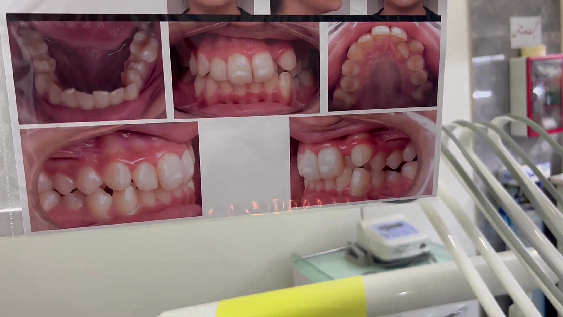 ارتودنسی دكتر مهدي فهيمي هنزائي