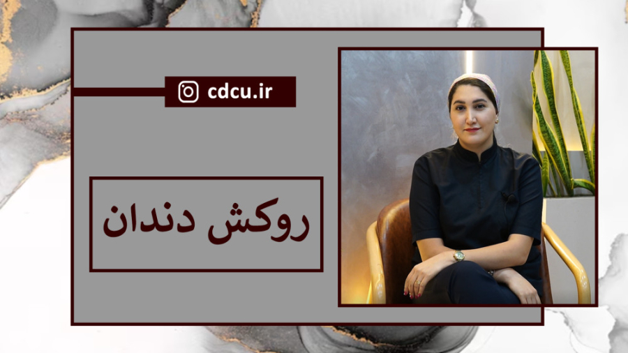 روکش دندان ترمیم سوختگی