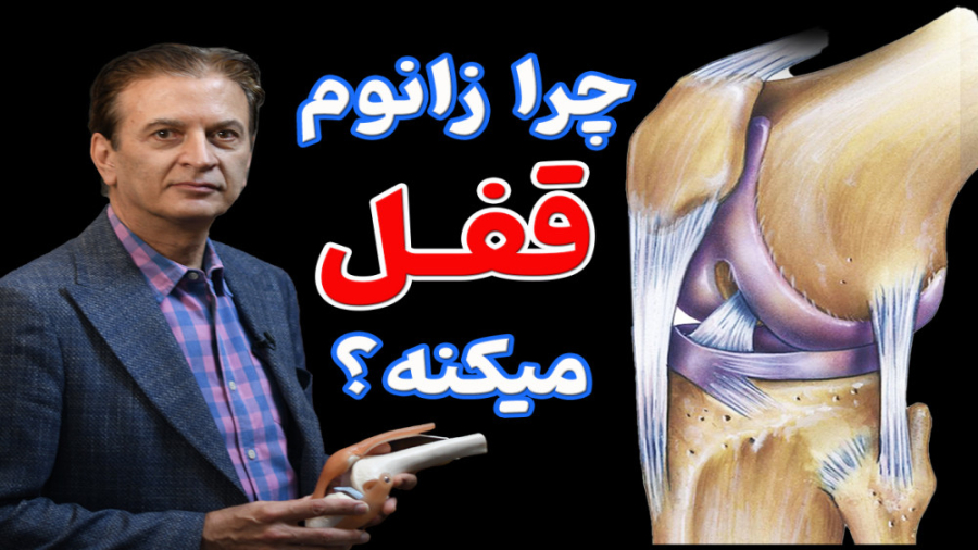 چرا زانوم قفل میکنه؟ دکتر محمود جعفر بیگلو