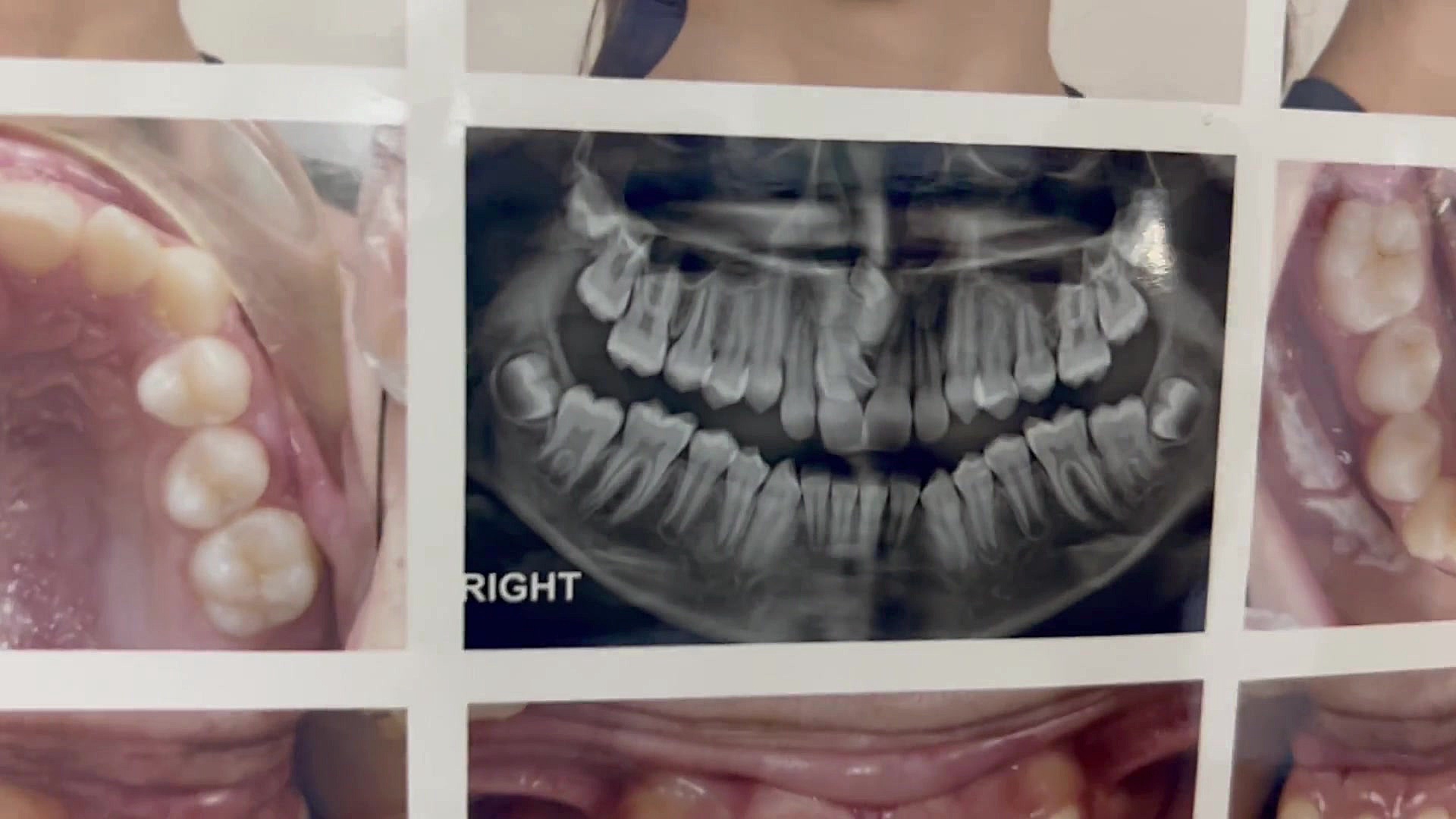 ارتودنسی دكتر مهدي فهيمي هنزائي
