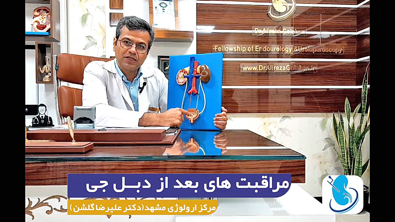 مراقبت های بعد از دبل جی