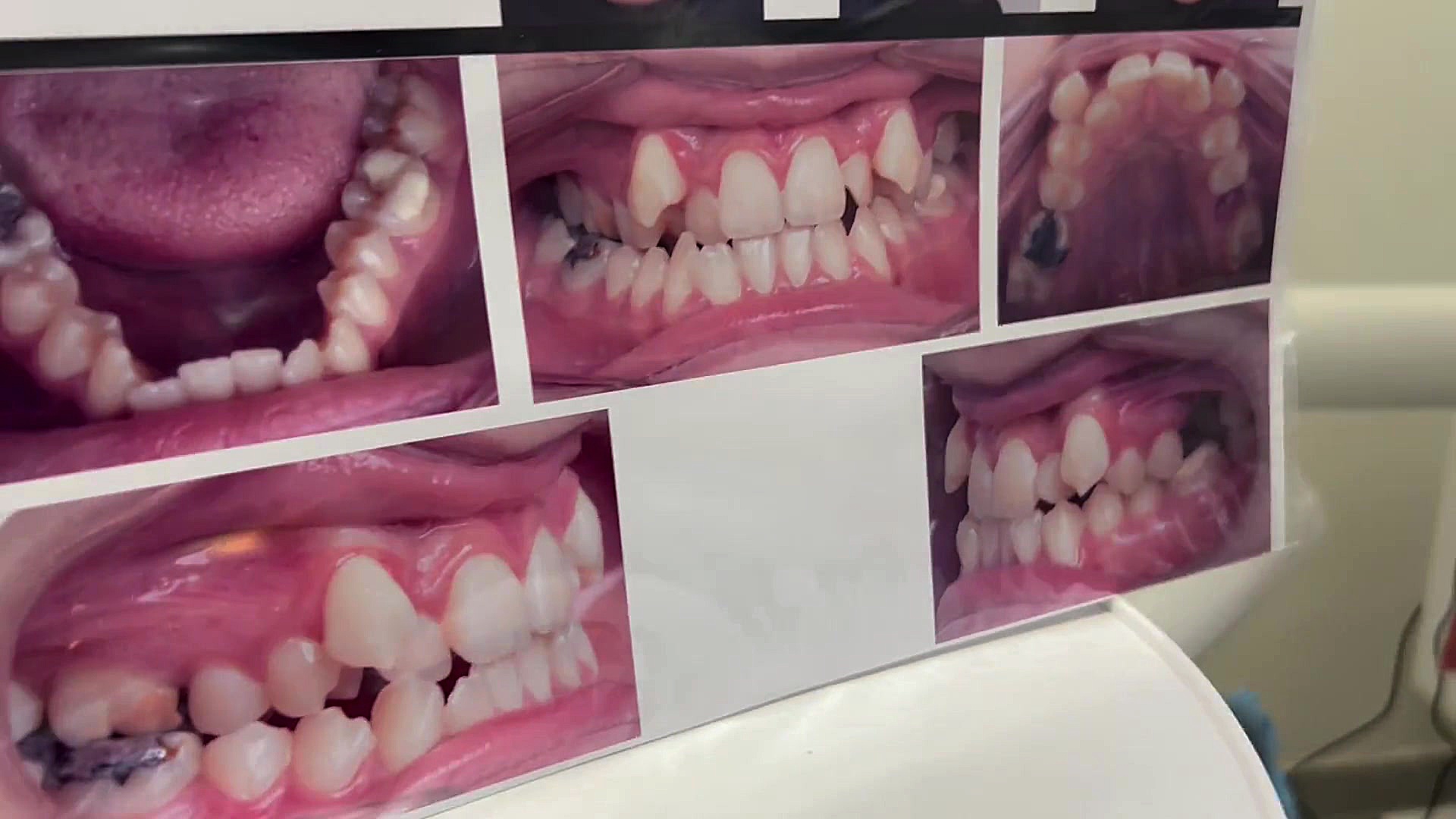 ارتودنسی دکتر مهدی فهیمی هنزائی متخصص ارتودنسی دكتر مهدي فهيمي هنزائي