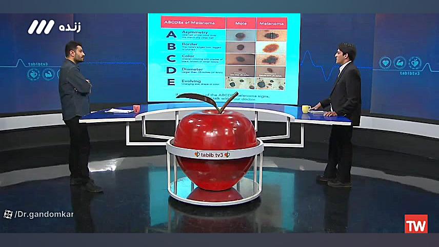علایم هشدار سرطان های رنگدانه ای پوستی ،دکتر حسین گندمکار .قسمت ششم پارت دوم روکش دندان