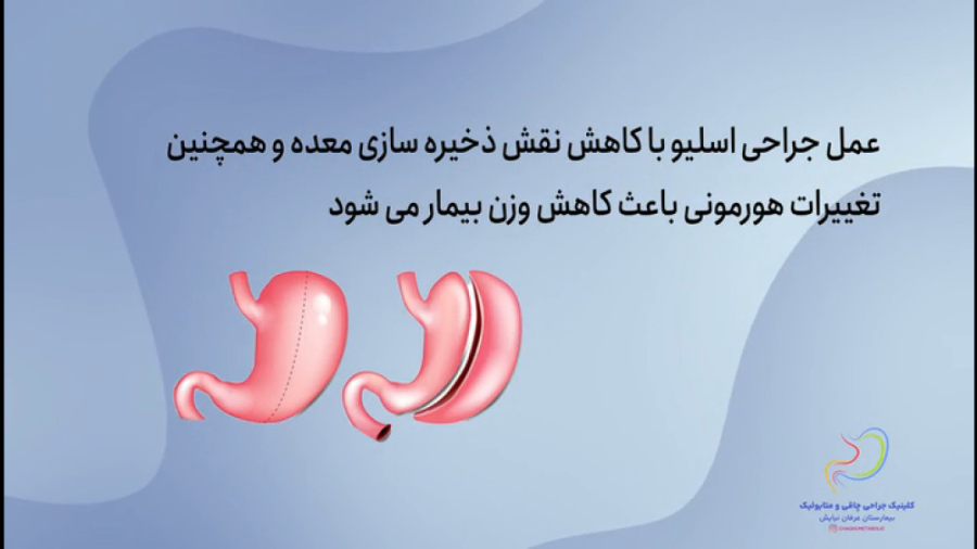 آیا چاقی یک بیماری است؟ Microarray