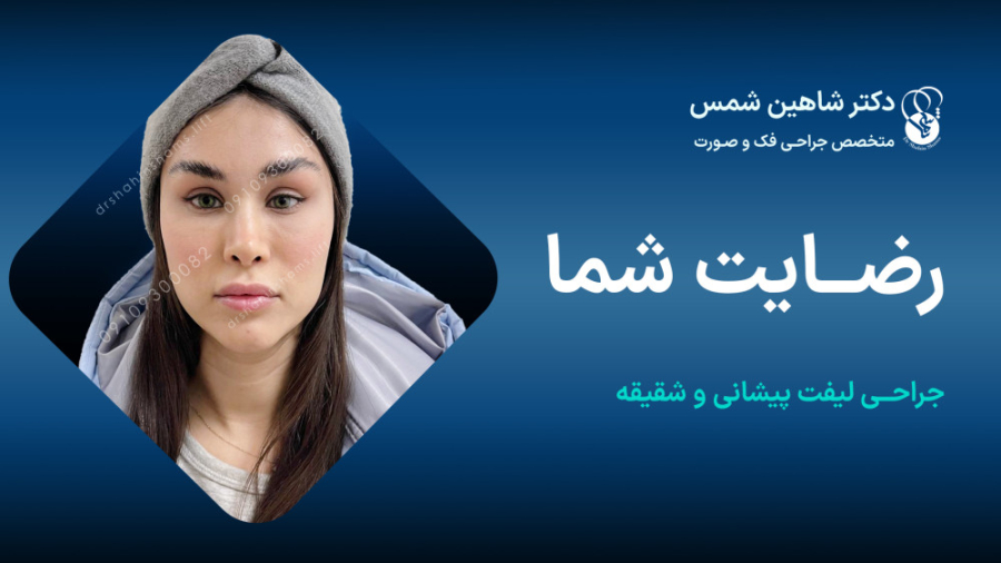 نظرات شما بعد از جراحی لیفت پیشانی پیلینگ