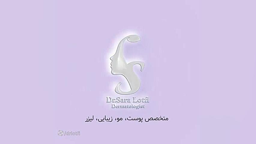 تزریق فیلر خط خنده و گونه دکتر سار ا لطفی