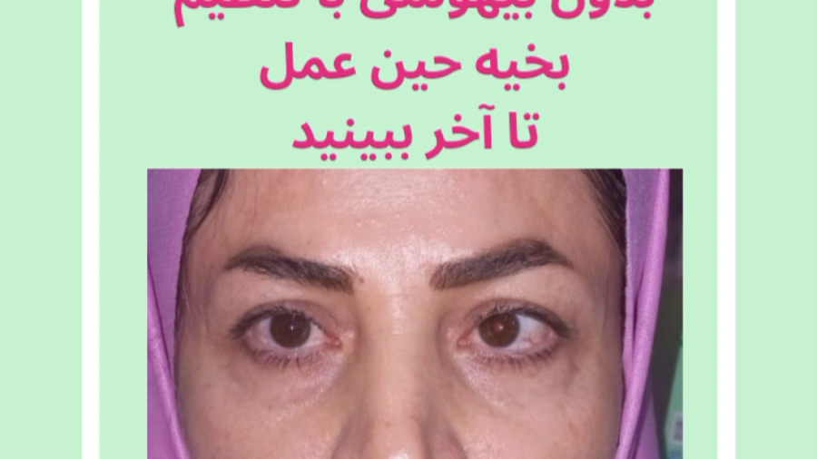 جراحی انحراف چشم بدون بیهوشی دکتر گزین، فوق تخصص استرابیسم کلینیک دندانپزشکیایمونولوژی پیوند