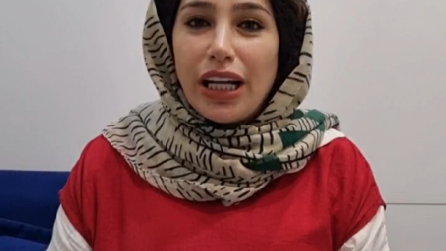جراحی زیبایی بینی دکتر مهرداد مقیمی - بینی گوشتی 1/5 سال بعد از عمل دکتر مهرداد مقیمی